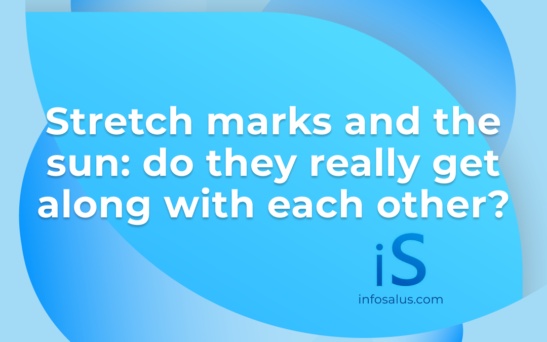 Stretch marks and the sun: do they really get along with each other?