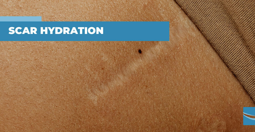 The importance of scar hydration