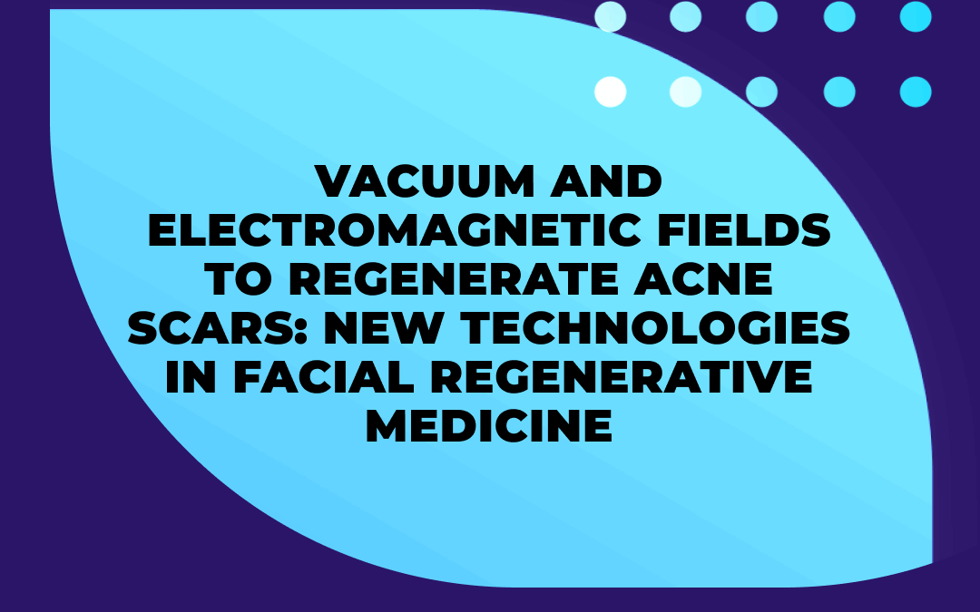 NEW STUDY: VEMFTHERAPY TO REGENERATE ACNE SCARS